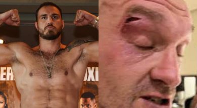 blessure-tyson-fury-boxe